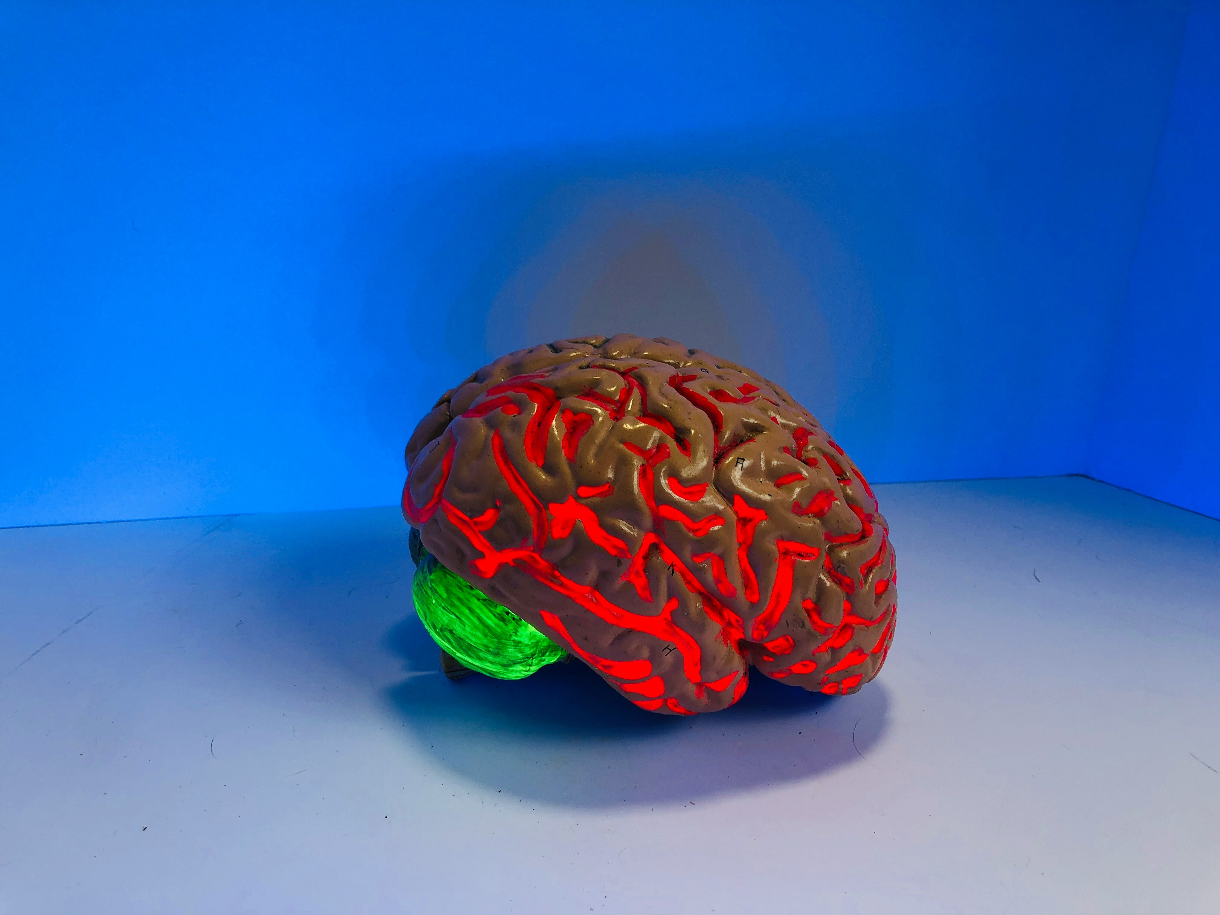 Redefining Alzheimer’s poses ‘potential harm to millions’